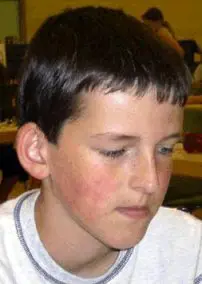 Martin Goepel (Willingen, 2003)