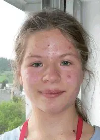 Julia Kirst (Willingen, 2007)