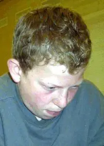 Martin Wolfgang Soeroes (Willingen, 2003)