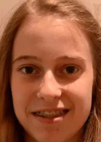 Anne Glaeser (Willingen, 2015)