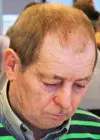 Benny Gronhoj